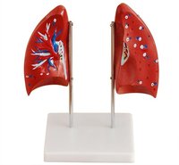 ConXport Lung Model