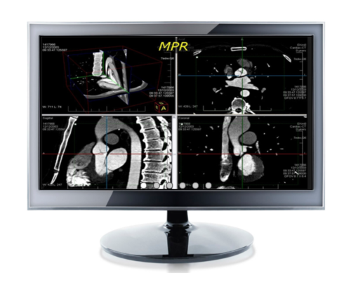 PACSPLUS Workstation(Radiology)