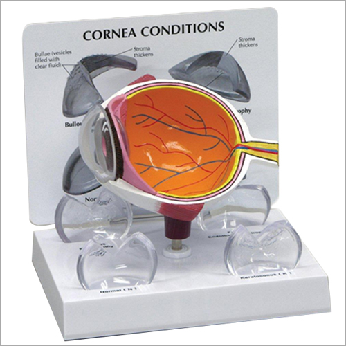 Eye Model With Cornea Condition