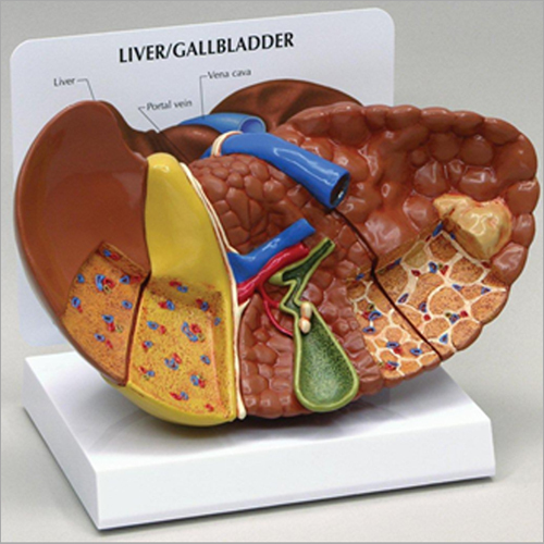 Liver Diseased Model