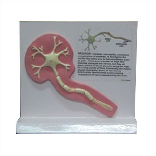 Diabetic Neuropathy Models