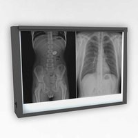 X Ray Film Viewer