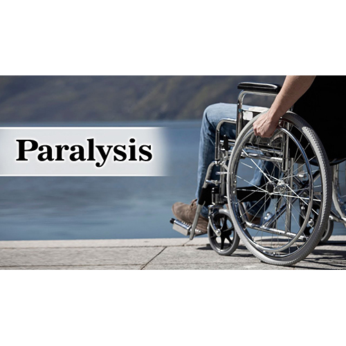Ayush Cure For Paralysis