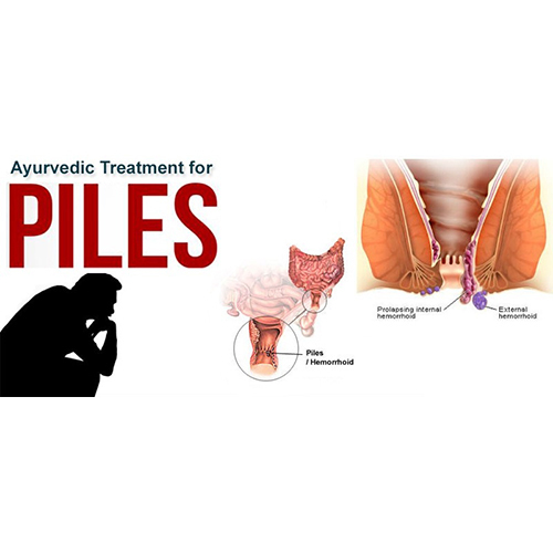 Ayush Cure For Piles