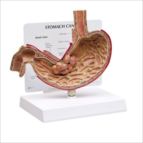 Pathological Stomach Model