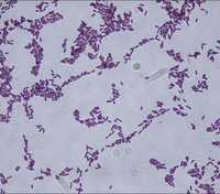 Bacillus Subtilis - Bacillaceae Strain, Promotes Healthy Growth & Nutrition, Store In Dry Place