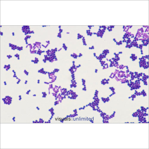 Clostridium Butyricum