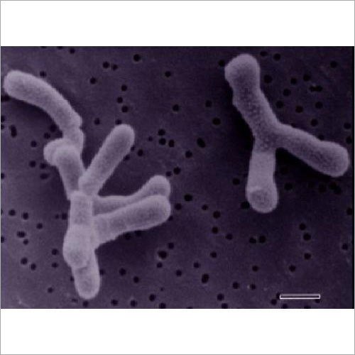 Bifidobacterium Infantis Probiotics