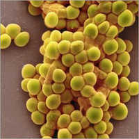 Streptococcus Thermophilus