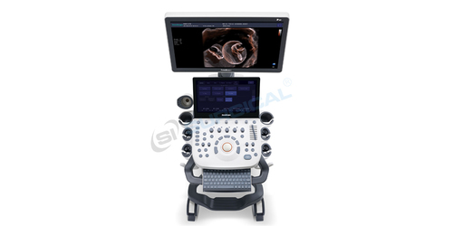 Ultrasound Machine P20