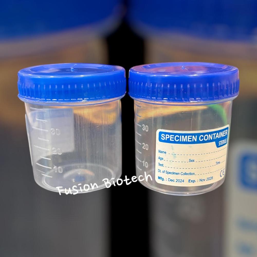 Urine Container 30ml