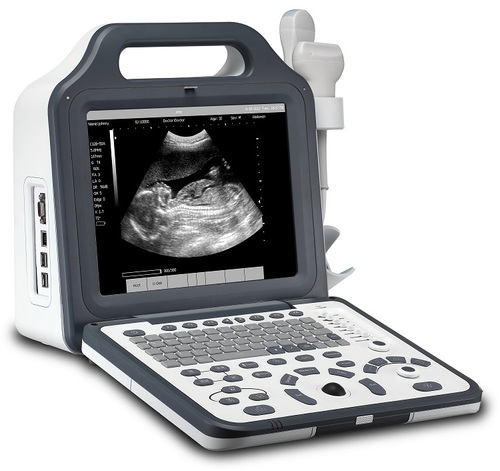 Digital Ultrasound Scanner By ABBAY TRADING GROUP, CO LTD