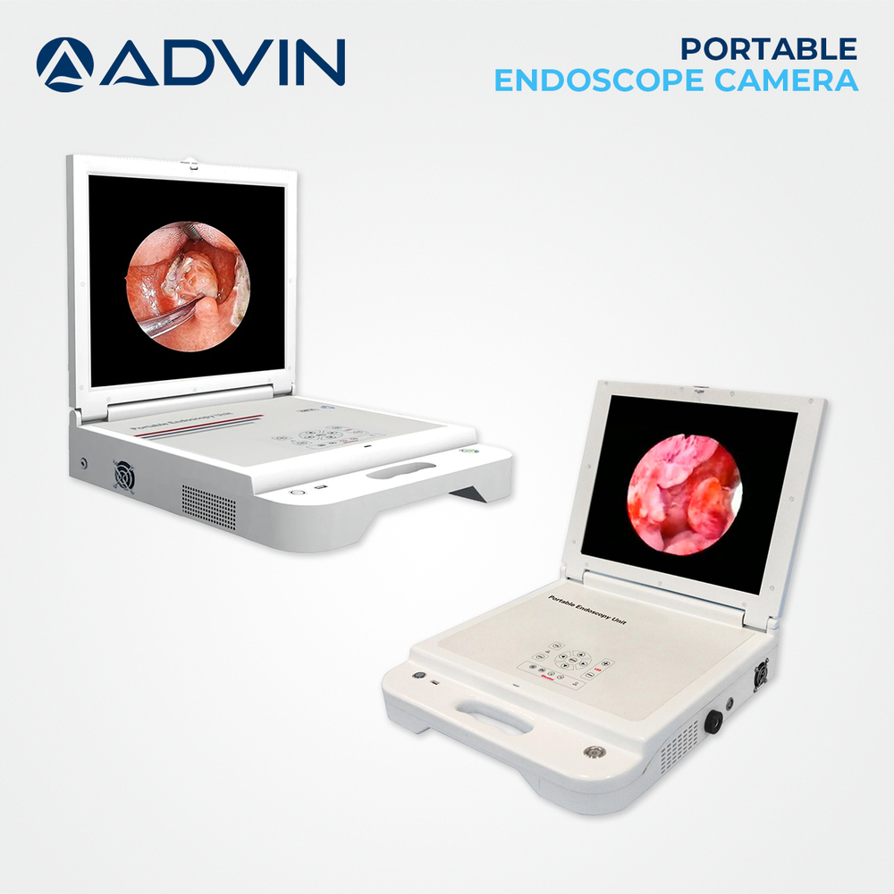 Portable Endoscope Camera