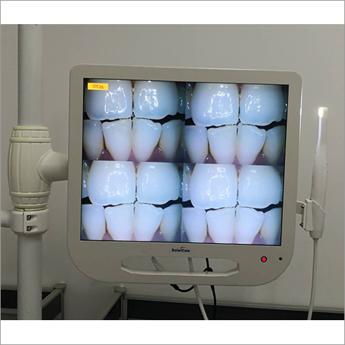 17 Inch LED Monitor with dental intraoral camera