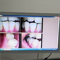 19 Inch Intraoral Camera With Touch Screen Monitor