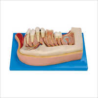 Lower Jaw Models of 12 Years Old