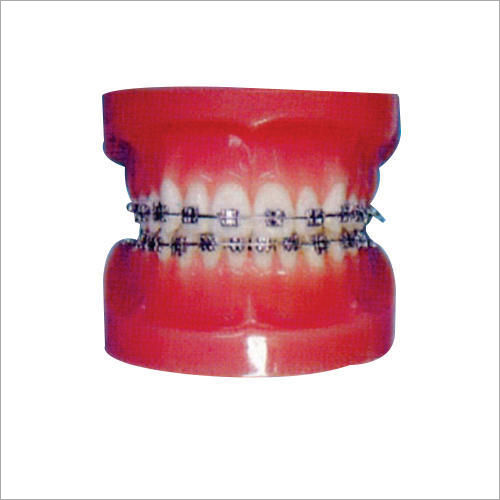 Fixed Orthodontic Models