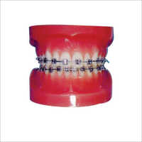 Fixed Orthodontic Models