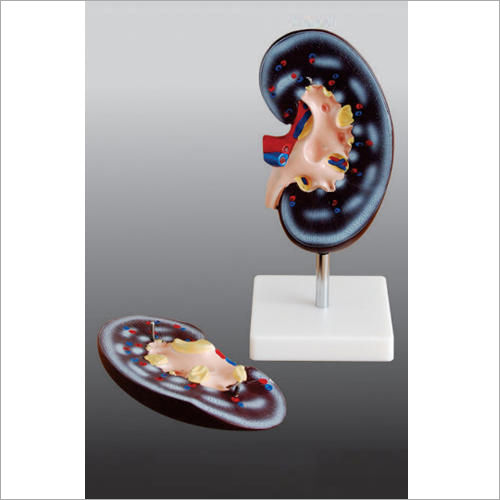 Life Size Kidney Models