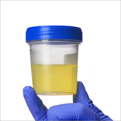 Transparent Plastic Urine Container Box