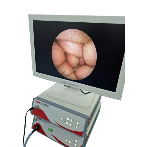Surgical Endoscopy Camera Monitor