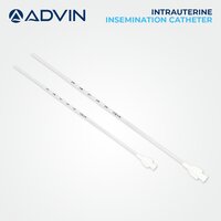 Intrauterine Insemination Catheter - Clear Polyethylene, 17cm Length X 2.00mm Od X 1.10mm Id, Sterile And Single Use, Flexible Body For Curvature Adaptation, Soft Inner Catheter With Smooth Entry And Rounded Tip