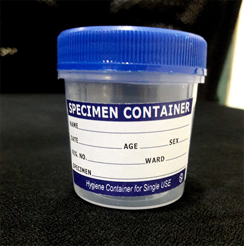 50ml Urine Container