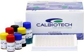 Cardiolipin IgG ELISA 96 test