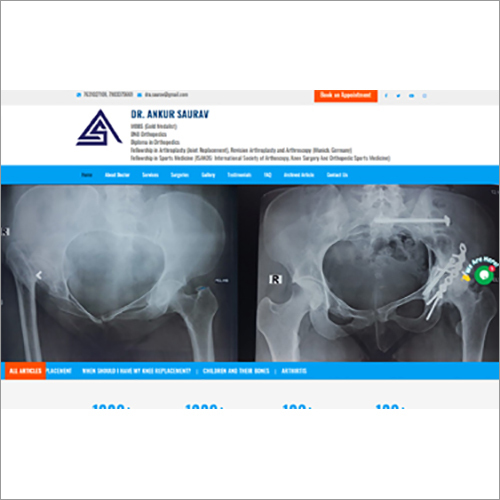 Joint Replacement Website Design Service