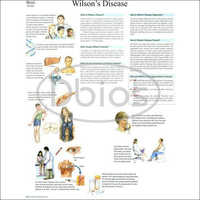 Wilsons Disease Chart