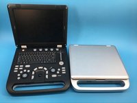 Safe To Use Ultra Sound Equipment Ultrasound Machine Portable Ultrasound Machine