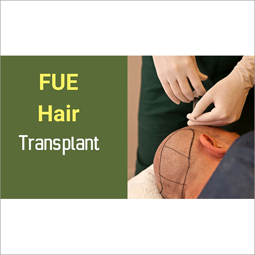 Fue Hair Transplant Treatment Services