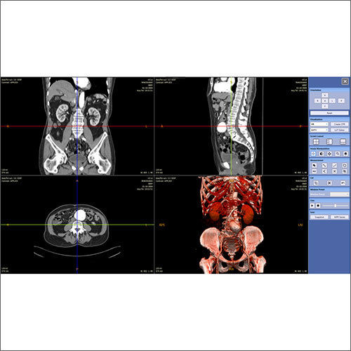 NeoRad Multi Modality Workstation