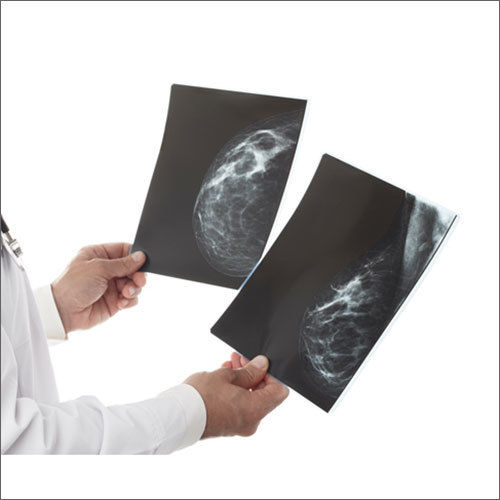 Breast Imaging