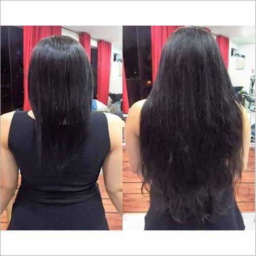 Human Hair Fixing Services By S.S. HAIR WEAVING CENTRE