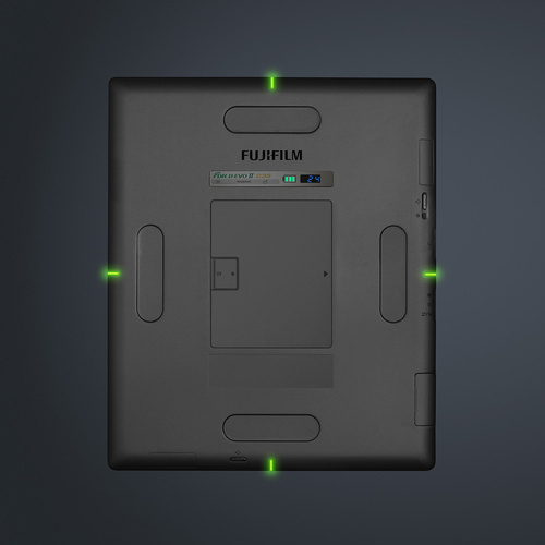 Retrofit Digital Radiography
