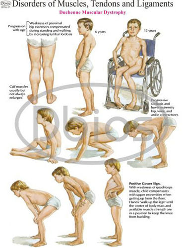 Anatomy Charts Models