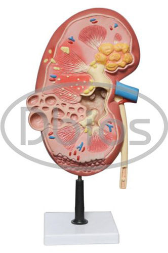 Pathology Model - Color: Multi Colour