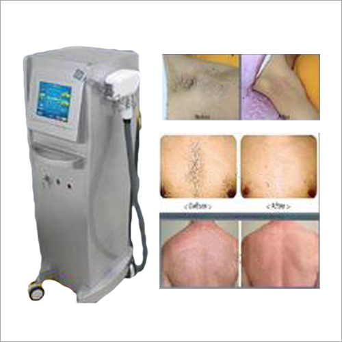 Diode Laser system (No Bela)