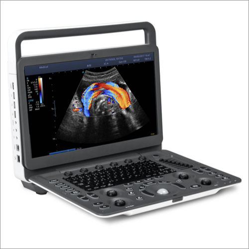 SonoScape E2 Ultrasound Machine