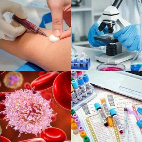 Blood Test Services