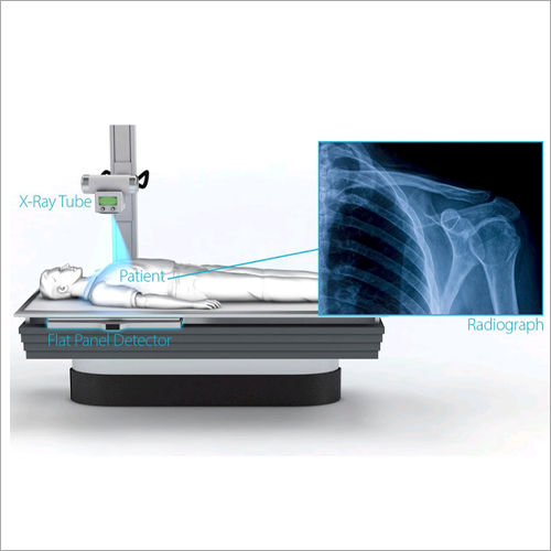 Abdominal  X Ray Service Light Source: Yes