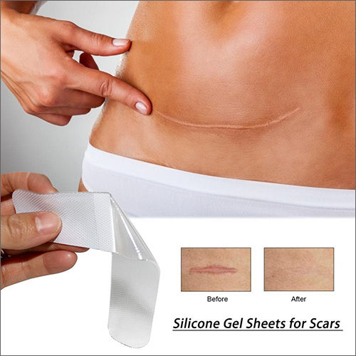 Silicone Scar Gel Sheet Age Group: Women