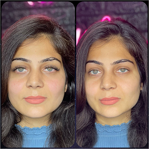 Permanent Eyelash Extensions