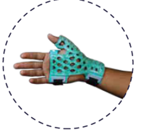 Thumb Spica Immobilizer - Large