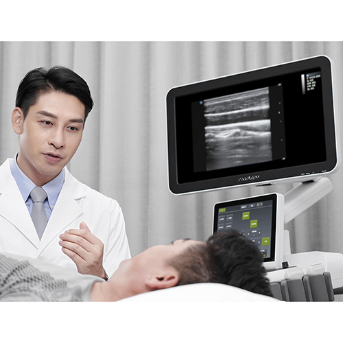 Diagnostic Ultrasound System