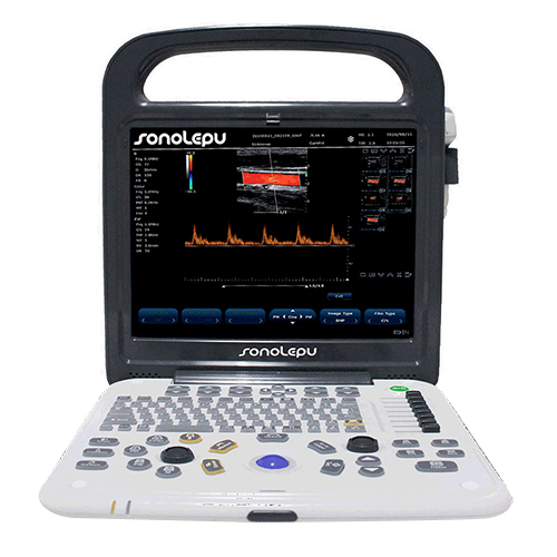 Diagnostic Ultrasound System For Hospital