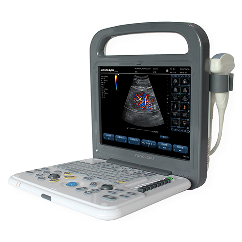 Diagnostic Ultrasound System For Hospital