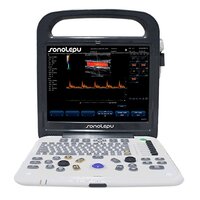 Diagnostic Ultrasound System For Hospital
