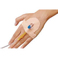 Cannula Fixator